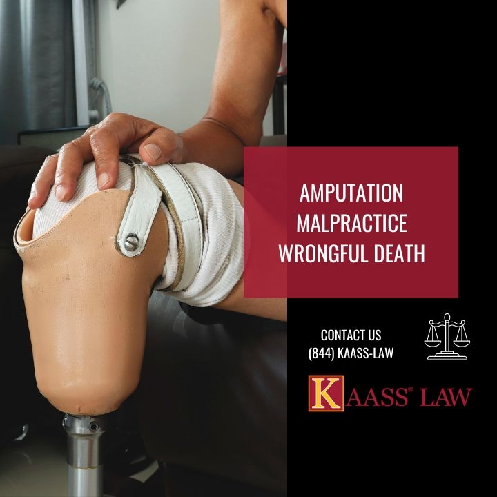 Amputation Malpractice Wrongful Death