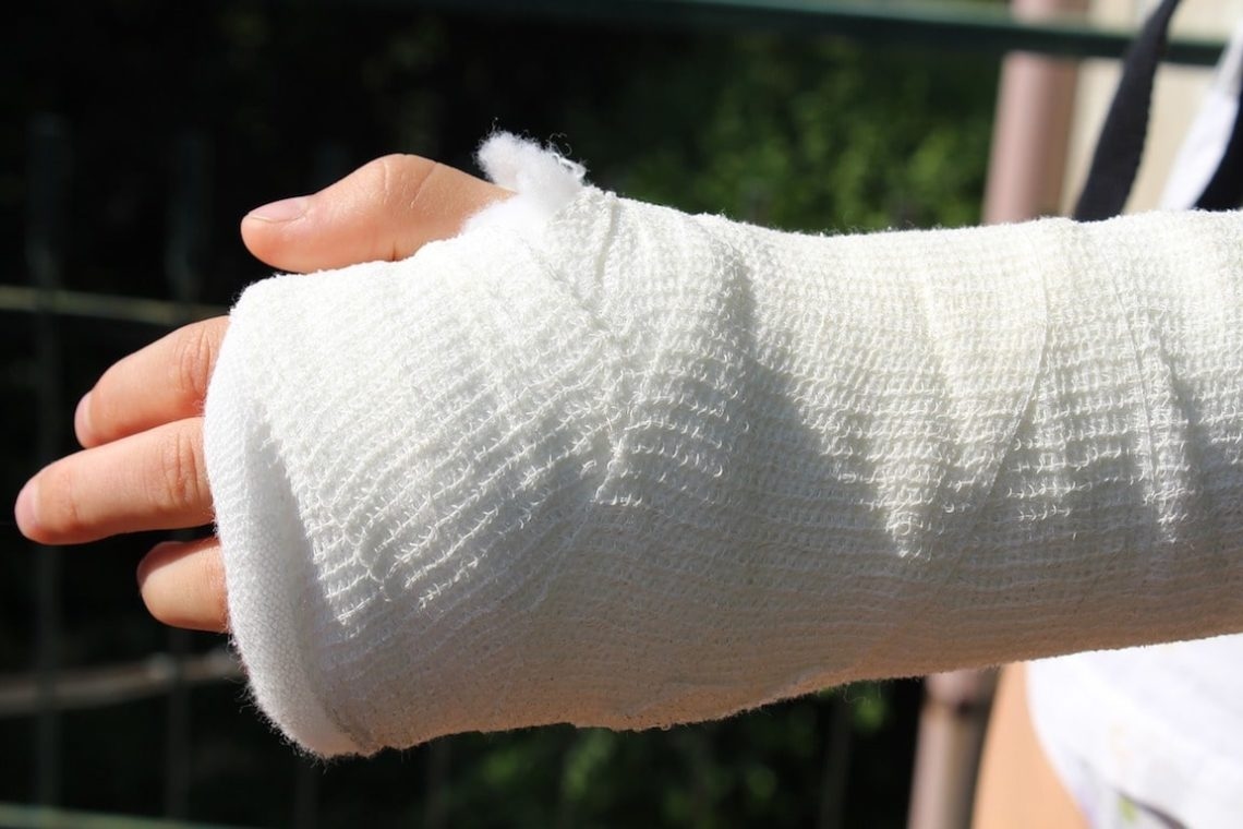 California Premises Liability Claims