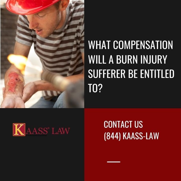 What Compensation Will A Burn Injury Sufferer Be Entitled To?