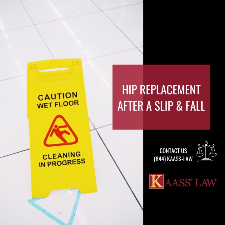 Hip Replacement After A Slip & Fall